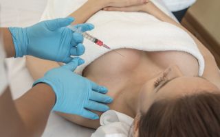 Augmentation mammaire à l'acide hyaluronique: avantages et inconvénients