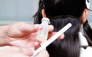 Ist Botox schädlich für Haare, Vor- und Nachteile