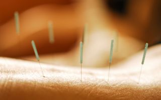 Varför akupunktur är användbart och vad behandlas det
