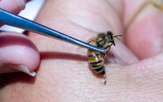Jad pszczeli: korzyści i szkody, co zrobić z użądleniem pszczoły w domu