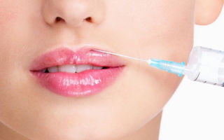 ¿Cuánto tiempo va a desaparecer la hinchazón de los labios después del ácido hialurónico?